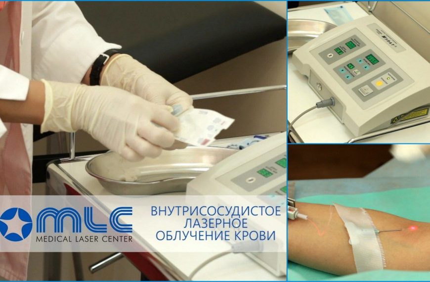 Внутривенное лазерное облучение крови (ВЛОК)