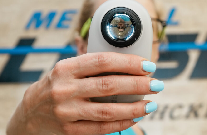 Hand with dermoscope