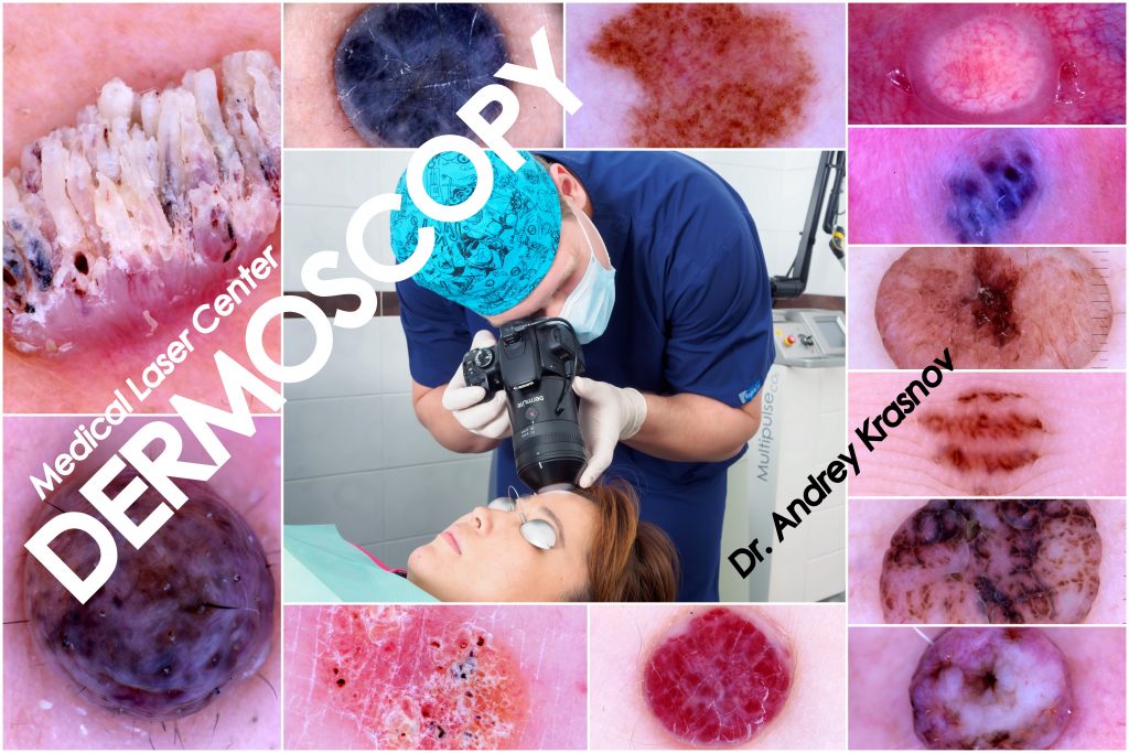 Красочный мир дерматоскопии
