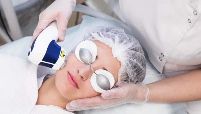 Удаление волос на лице: лазерная эпиляция для женщин и мужчин