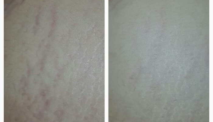 img_20170109_095003_641