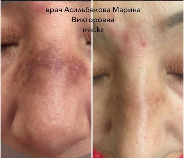 20170301_041340000_ios