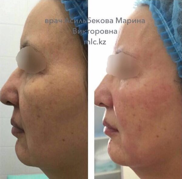 20170301_041408000_ios