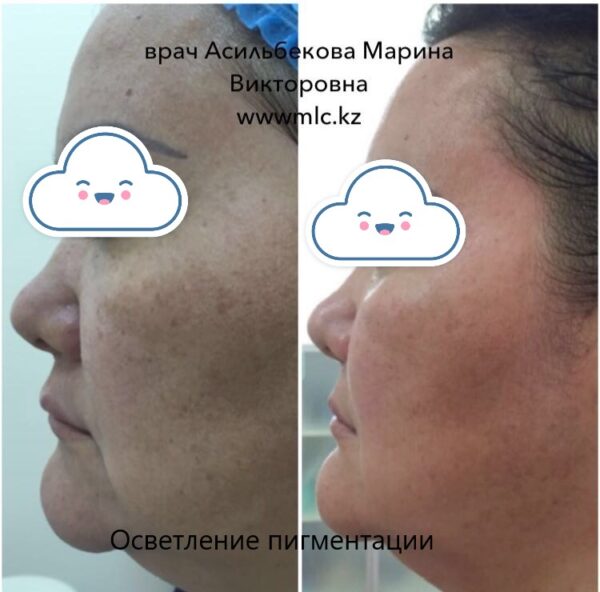 20170301_041518000_ios-1