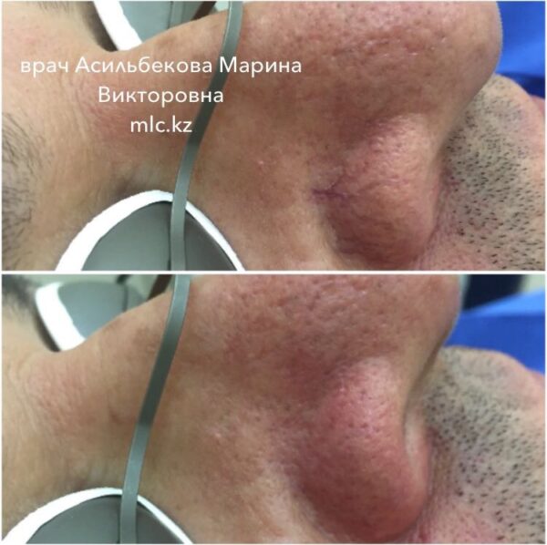 20170301_041532000_ios