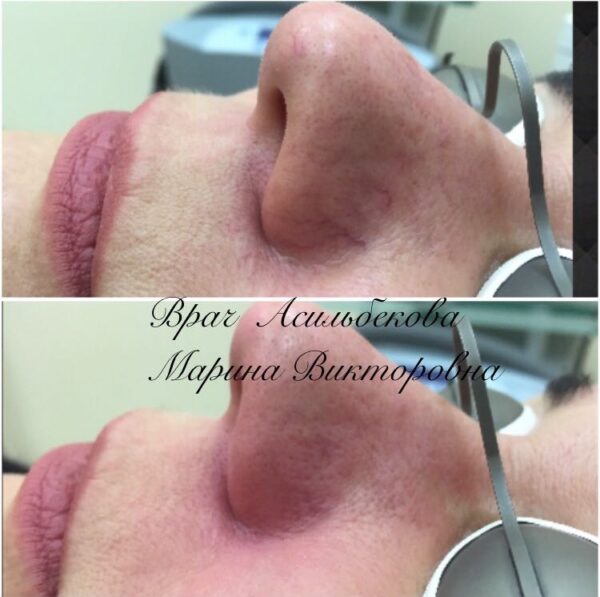 20170301_041558000_ios