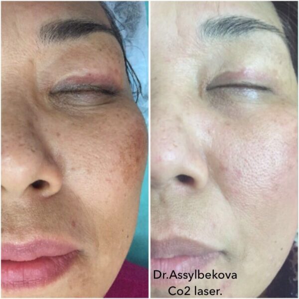 20170301_041823000_ios