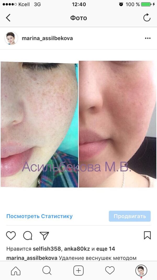 20170301_064822000_ios