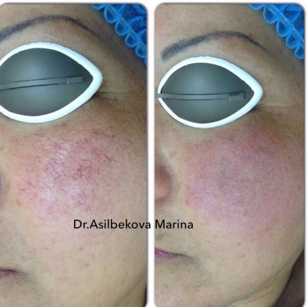 20170301_064825000_ios