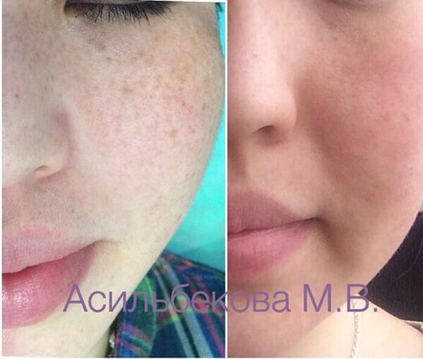 20170301_064847000_ios