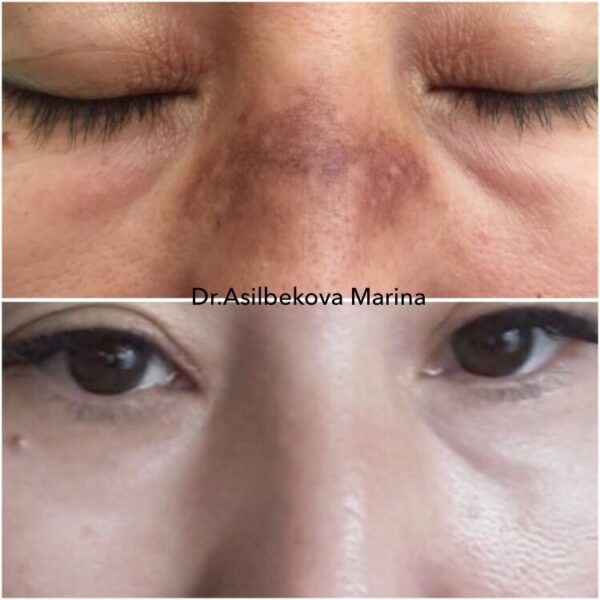 20170301_075809000_ios