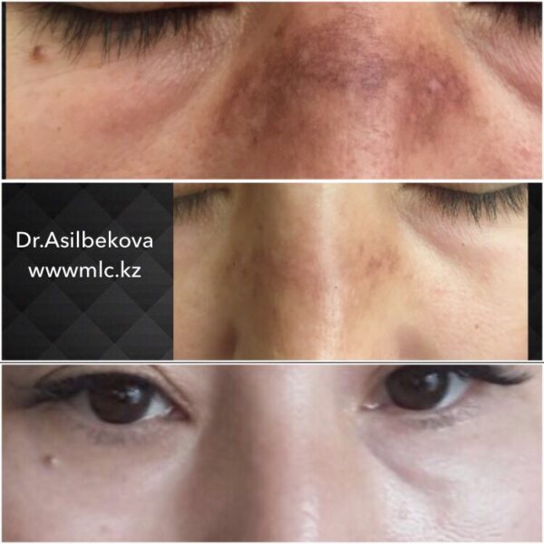 20170301_075812000_ios