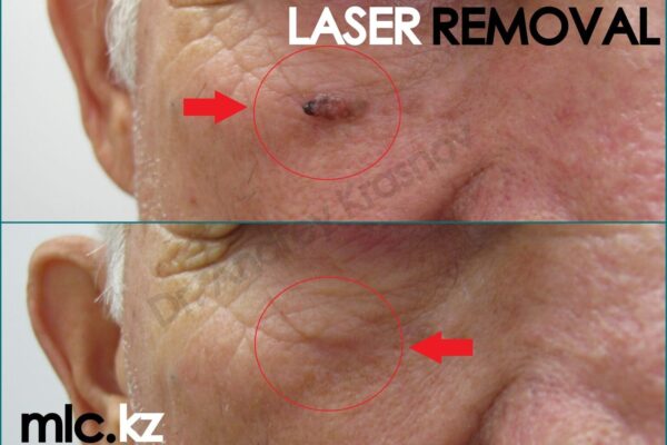 attention-best-1-2048x1448