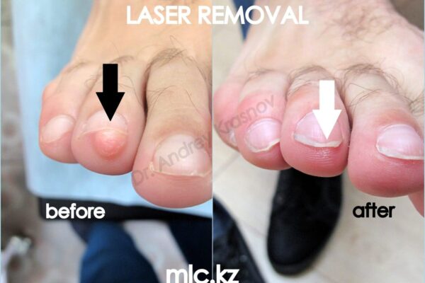 fibroma-3-1-2048x1448