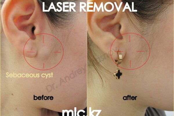 img_20190605_203027_626-2048x1448