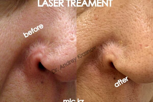 lt-of-scars-11.11-1-2048x1448