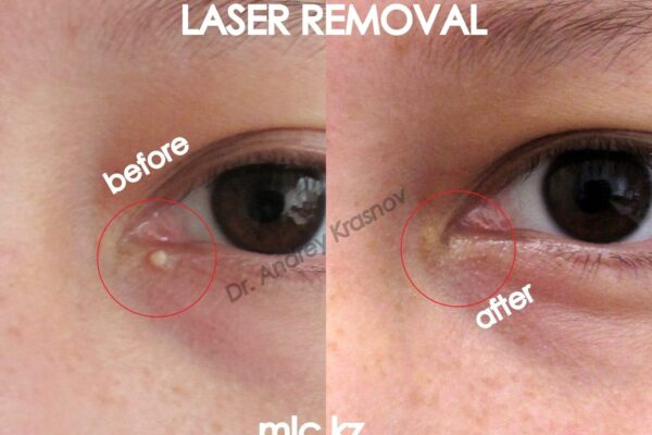 milium-27.12-4-2048x1448