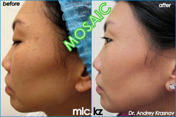 mosaic-2-1-2048x1365