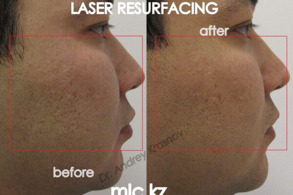 mosaic-ereke-3-2048x1448